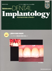 DENTAL Implantology Vol.16